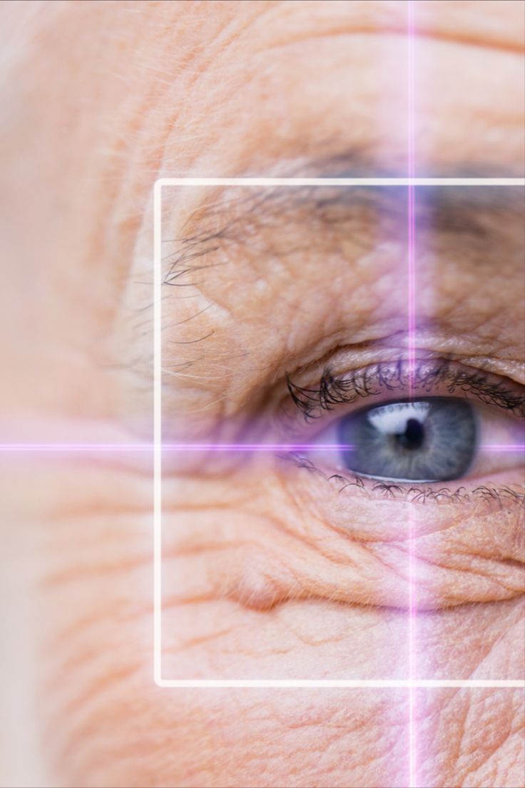 Glaucoma treatment in Amritsar, Glaucoma Specialist in Amritsar