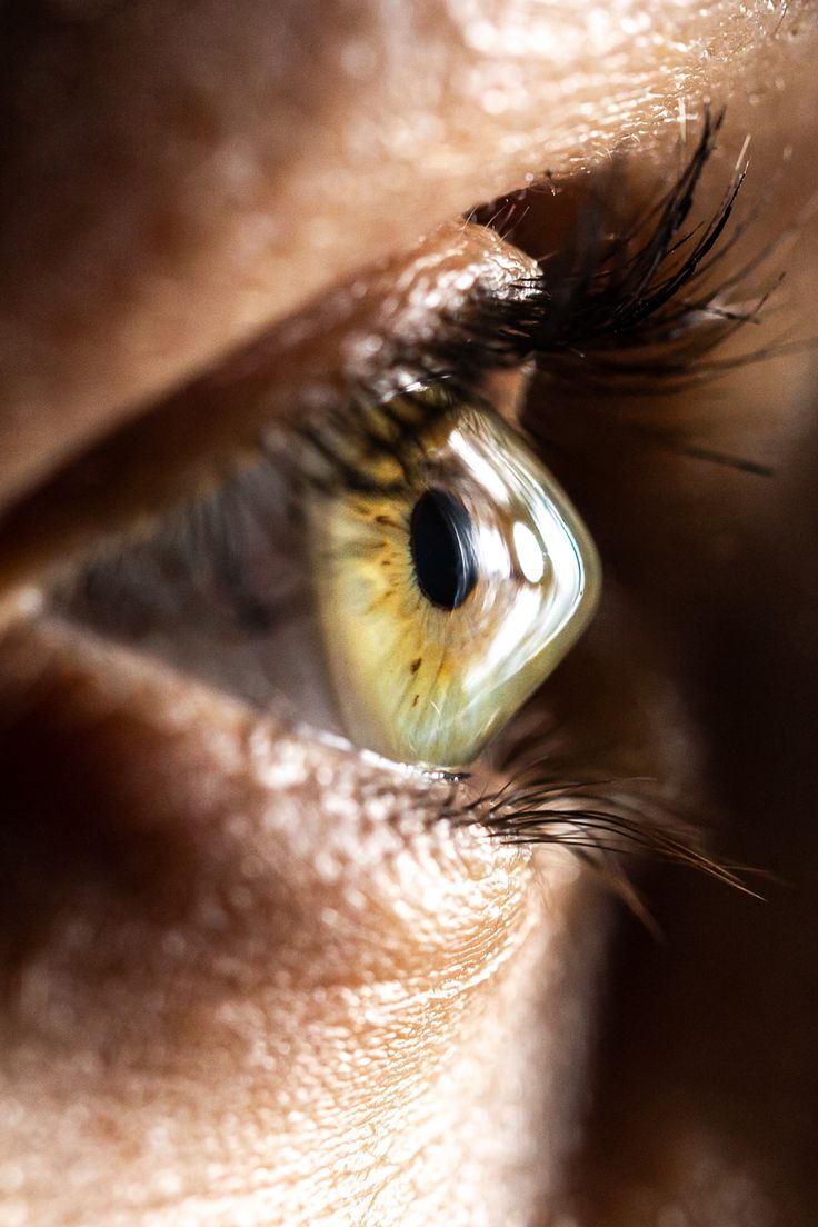 Keratoconus treatment Amritsar